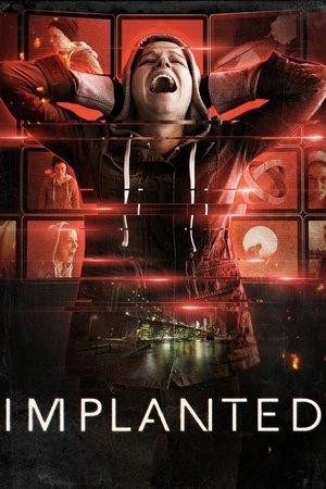 Poster - Імплант